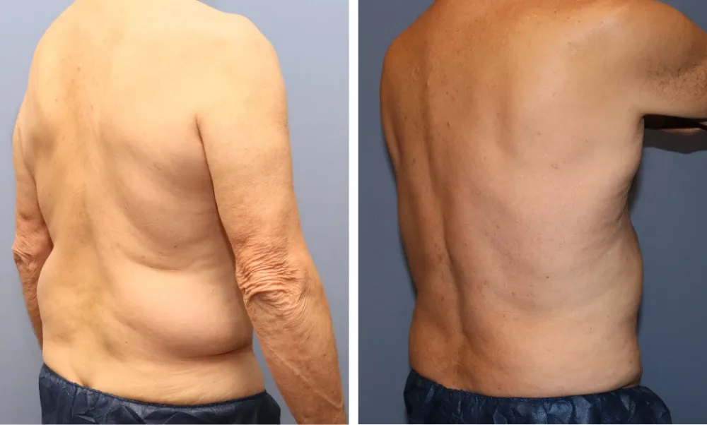 Case_ LIPO-001 (3)