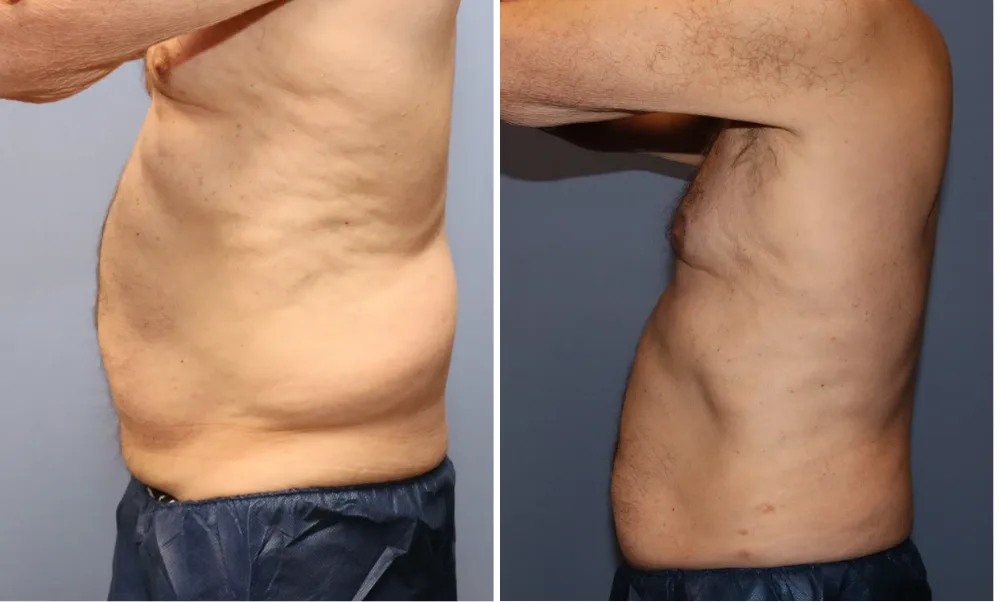 Case_ LIPO-001 (5)