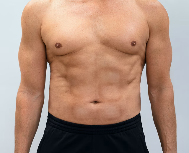 Fat Injections