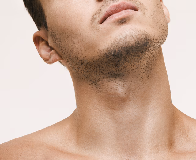 Neck Lift